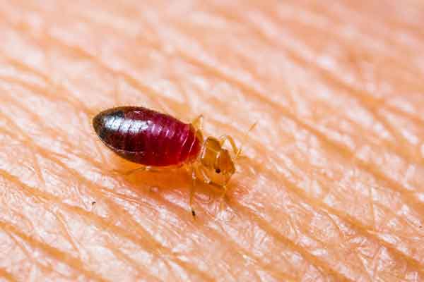 close-up photo of bedbug on human skin