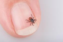 spider on person's nail