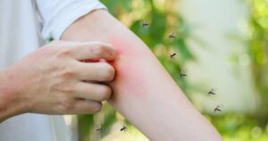 mosquito season in Tampa